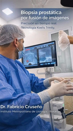 Dr. Fabricio Cruseño on Instagram: "Esto no es solo una imagen. Es precisión aplicada al diagnóstico. La biopsia prostática por fusión de imágenes nos permite integrar resonancia y ecografía en tiempo real, dirigiendo cada toma al sitio exacto. Más certeza diagnóstica. Menos azar. Mejores decisiones terapéuticas. Detectar a tiempo el cáncer de próstata no solo mejora el tratamiento. Puede cambiar el curso de una vida. En el Instituto Metropolitano de Urología trabajamos con tecnología de alta co