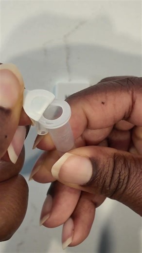 How to Test for Hepatitis C at Home | Rapid Hep C Blood Test Self-Test Walkthrough