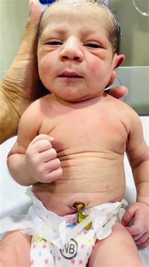 A cute panda 🐼 baby #baby #neonatologist #cutebabies #niculife #cute #cutechildren #newborn #cuteki