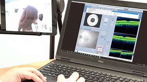 How to perform an OCT exam with a Remote Connection to the CIRRUS OCT