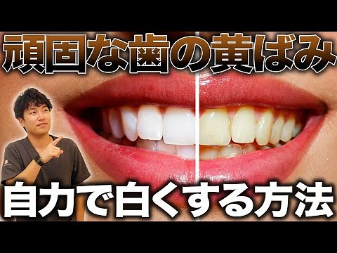 【歯を白くする方法】自力で歯の黄ばみを落とす方法を医師が解説！