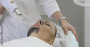 Close-up of carbon peeling procedure for adult woman. Laser rejuvenation and clean skin of the face. Stock Video
