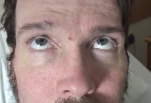 Spasm of the Near Reflex | NOVEL - Neil R. Miller Collection