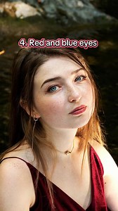 68K views · 2.2K reactions | Which one did you find most interesting? #rare #funfacts #genetics | JSEAY Fans | Facebook