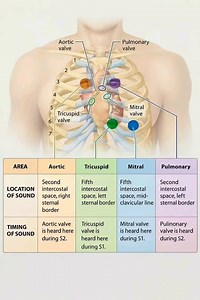 Understanding where to listen for heart sounds is essential for accurate cardiac assessment. This visual guide breaks down the four primary auscultation points—Aortic, Pulmonary, Tricuspid, and Mitral—showing exactly where each valve’s sounds are best heard on the chest. The diagram highlights the intercostal spaces and sternal landmarks, while the color-coded chart explains both the location and timing of each valve’s sound during the cardiac cycle (S1 or S2). Perfect for medical students, nurs
