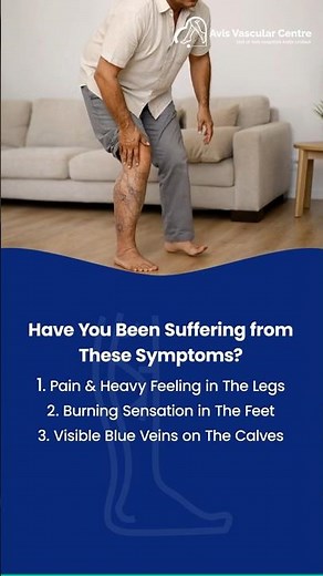Understanding Varicose Veins: Symptoms, Stages, and Treatments | Avis Vascular Centre