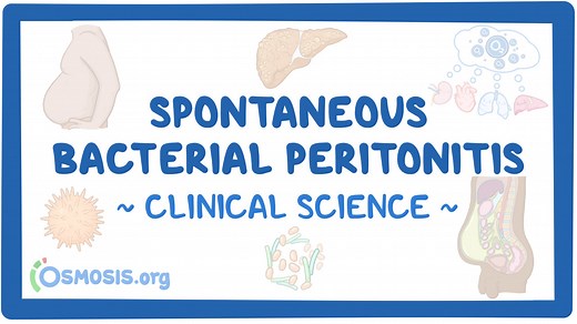 Spontaneous bacterial peritonitis: Video & Meaning | Osmosis