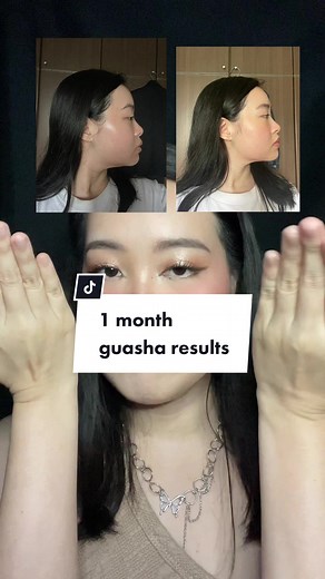 One Month Gua Sha Results: Before and After Transformation