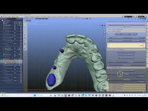 🦷 Tutorial on how to make an upper bridge