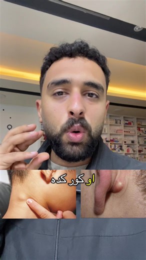 الغدد الليمفاوية: الأعراض وأسباب التورم