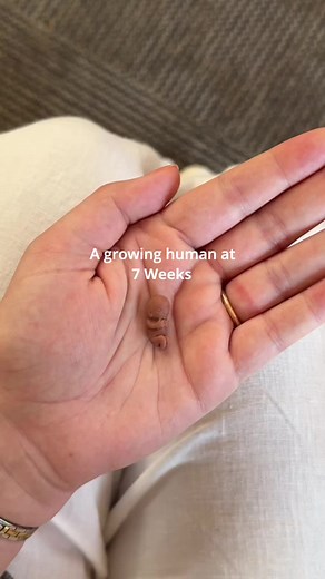 Baby Ultrasound: 7-10 Weeks Pregnant in Milwaukee