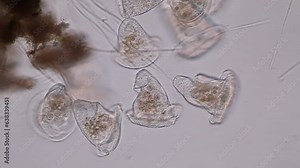 Study of protozoa and Algae under the microscope for education.