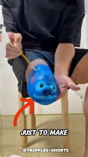 This Father Turned His Prosthetic Leg Into A Cartoon Character 🦾🎨❤️