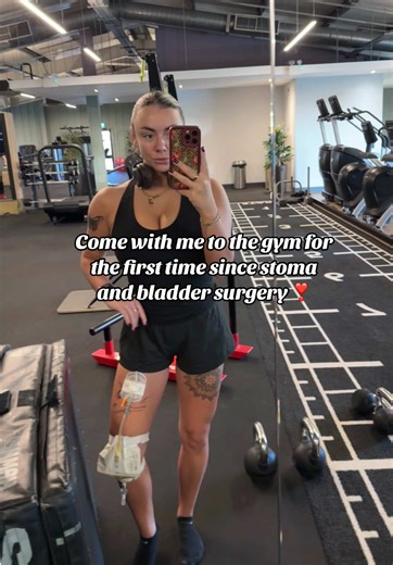 “You can’t exercise with a stoma bag and a catheter!” Well…. Watch me 🤪 Come with me to my first proper gym session post open bladder surgery and stoma surgery! ❤️‍🩹 (I did a few more exercises but not recorded) So happy that I get to go back to my happy place, let the rebuild begin ❣️