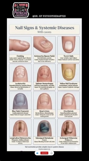 Nail Signs & Their Hidden Diseases | Don’t Ignore These Symptoms!