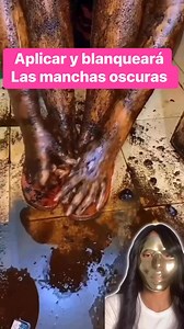 2.8M views · 29K reactions | Truco para blanquear en zonas oscuras #viralpost2025シ #facebookreelsviralchallenge #trucos | Medicina natural para todos | Facebook