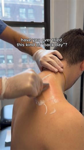 6.1K views · 13 reactions | Tight shoulders? — Scrape. Release. Recover  Scraping & Scapula Release help: • Improve blood flow • Release muscle tension • Break up fascial adhesions • Enhance shoulder mobility and posture #scrapingtherapy #scapularelease #bodywork #getadjusted #mobility #recover | Get Adjusted Chiropractic P.C. | Facebook
