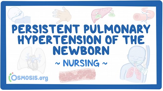 Persistent pulmonary hypertension of the newborn (PPHN): Nursing: Video & Causes | Osmosis