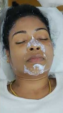 Laser Skin treatment for Acne Scars