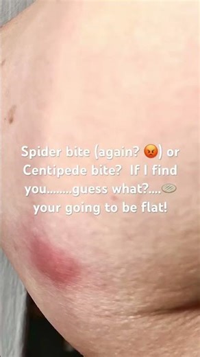 Squashed flat is the future prediction