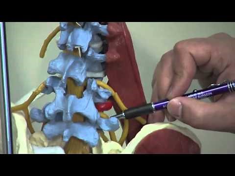 Spine Treatment Center - Nerve Root Block, Non-Surgical