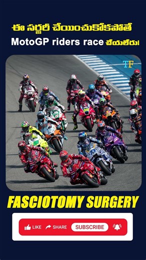 MotoGP Riders ఎందుకు Fasciotomy Surgery చేయించుకుంటారు?
