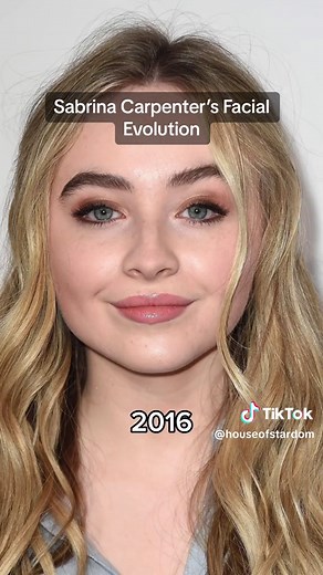 Sabrina Carpenter Before and After: Plastic Surgery Transformation