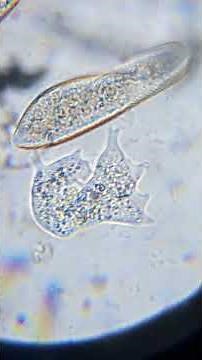 амёба + инфузория туфелька #microscope #микроскоп #микрофлора #science #biology #aquarium