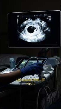 Test negative…still PREGNANT😳#healthawareness #doctor