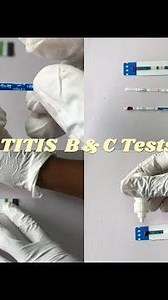 HOW TO DO HIV, HEPATITIS B & HEPATITIS C Virus Tests Yoursef