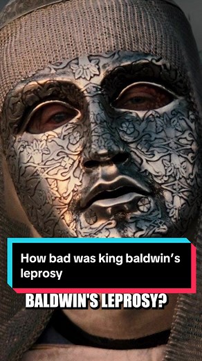 How bad was king Baldwin’s leprosy #history #historytok #kingbaldwin #baldwiniv #leperking