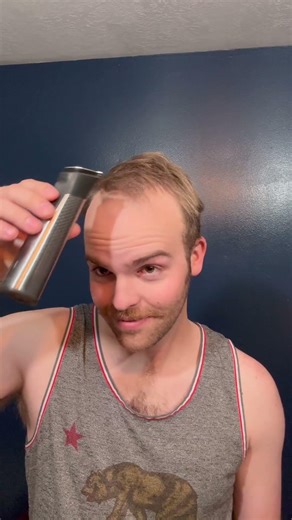 BALDING Man 22 Has Life Changing Transformation