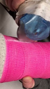 7.6K views · 230 reactions | And here goes the cast! Finally the left hand returns to the keys in full this weekend for KHB BrewSki Tour! | Kyle Hollingsworth | Facebook