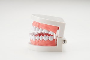 「即時義歯」とは？抜歯直後から保険適応で作れる仮入れ歯 [歯・口の病気] All About