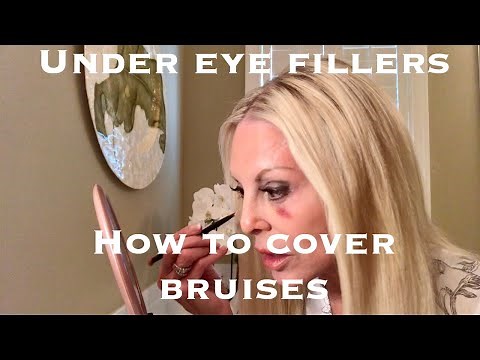 😱 UNDER EYE FILLER ~ HOW I COVER A BRUISE | The Style Chase |