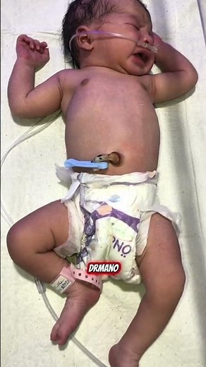 Cute Baby Getting Breathing Support in NICU 💙#CPAP #NICU #Newborn