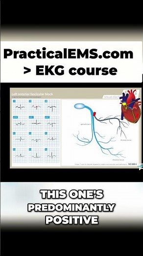 Pathologic Left Axis Deviation Explained: Visual Guide to Heart Block #shorts