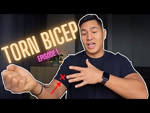 Distal Bicep Rupture 2023 | Fast Bicep Tendon Rehab (Surgical route)