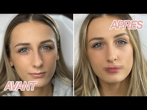 MES NOUVELLES LÈVRES