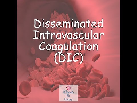Part 3: Disseminated Intravascular Coagulation (DIC)