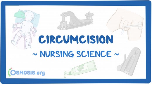 Circumcision: Nursing: Video & Causes | Osmosis