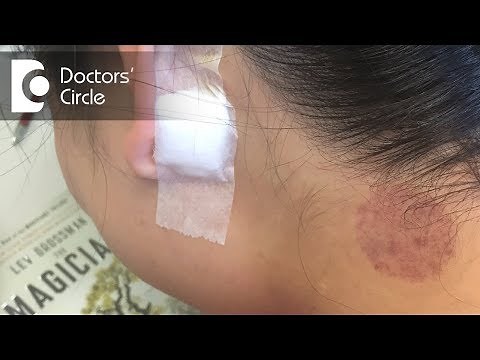 What causes itching & swollen lymph nodes near both the ear lobes? - Dr. Satish Babu K