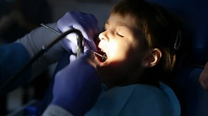 Little Girl Dentist Has Tooth Treated Stock Footage Video (100% Royalty-free) 3519212 | Shutterstock