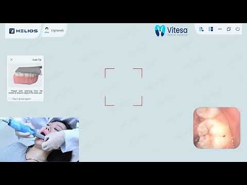 ESCANER INTRAORAL HELIOS 500 TUTORIAL