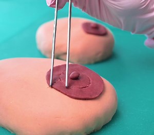 981K views · 3.6K reactions | Body Surgery Explained: What Really Happens Inside | Health is Wealth | Facebook