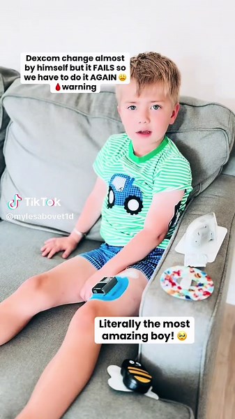 Type 1 Diabetes Challenges: Dexcom Device Failure Experience