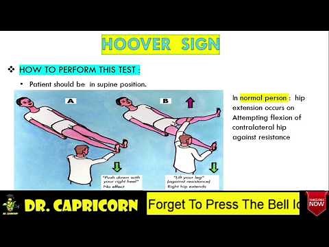 HOOVER'S SIGN /LEG PARESIS/CROSSED-EXTENSOR REFLEX/COPD/EMPHYSEMA/NEET/ USMLE step 1 /MBBS MADE EASY