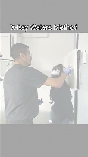 X-Ray Positioning Facial Bones Waters Method Parietoacanthial projection‪@YourXRayTech‬ 🩻