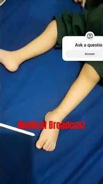 How to Check lower limb reflexes in pediatrics patients. #pediatrics #neurologicaldisorders #health