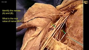 41 reactions | What is the root value of nerve (B)? Confirm your...